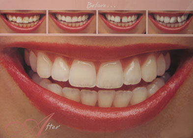 Trust Us for Your Dental Emergency in Toronto